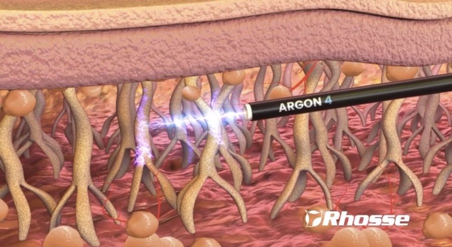 Argoplasma