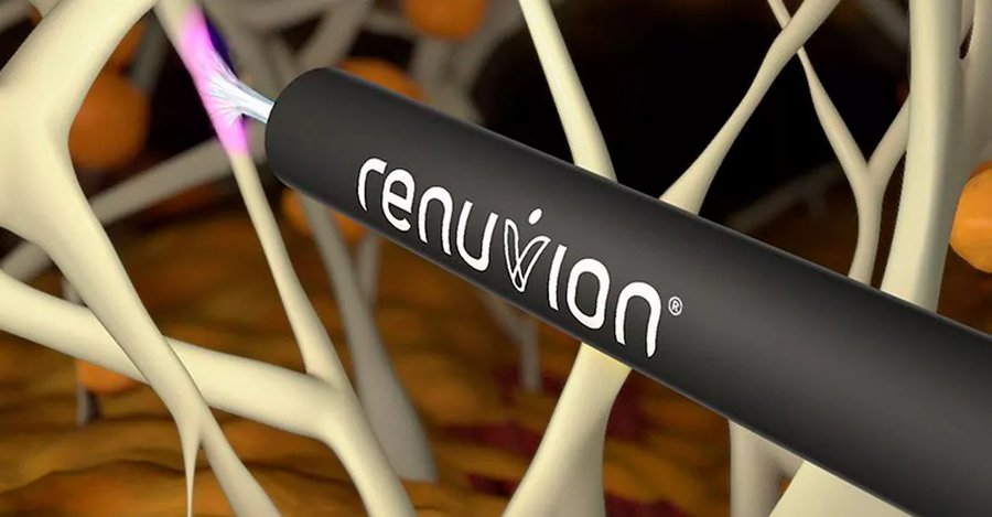 Renuvion
